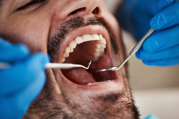 Best Emergency Gum Pain Relief  in Sky Valley, CA